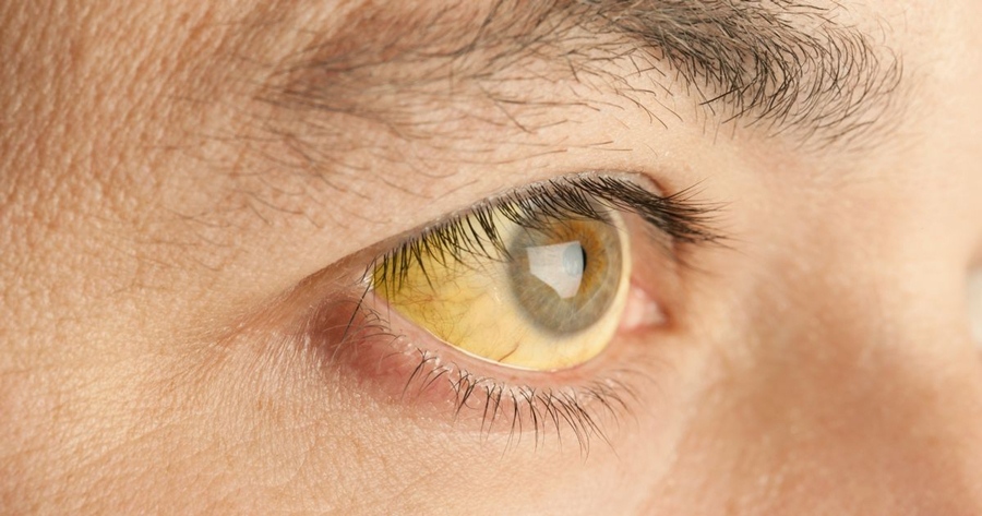 leads to eye problem