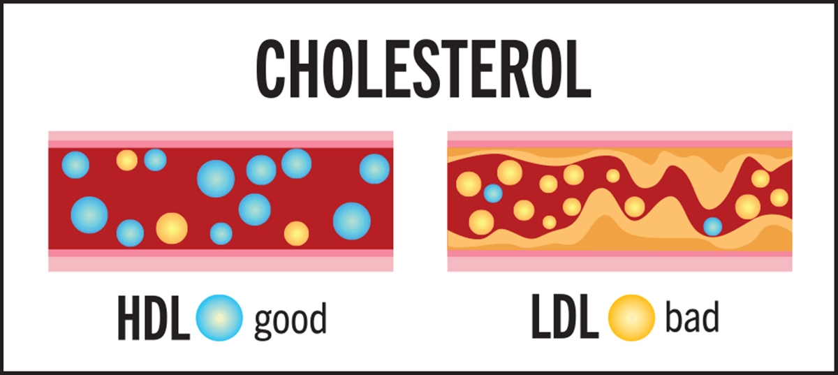 ldl cholestrol